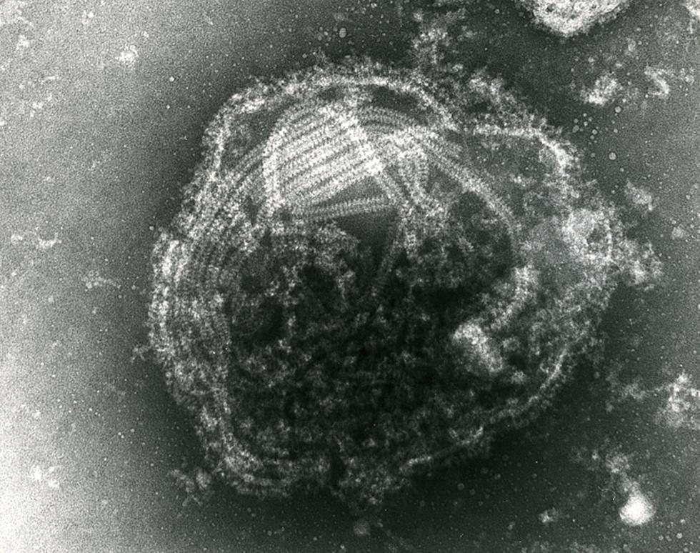 Mumps virus